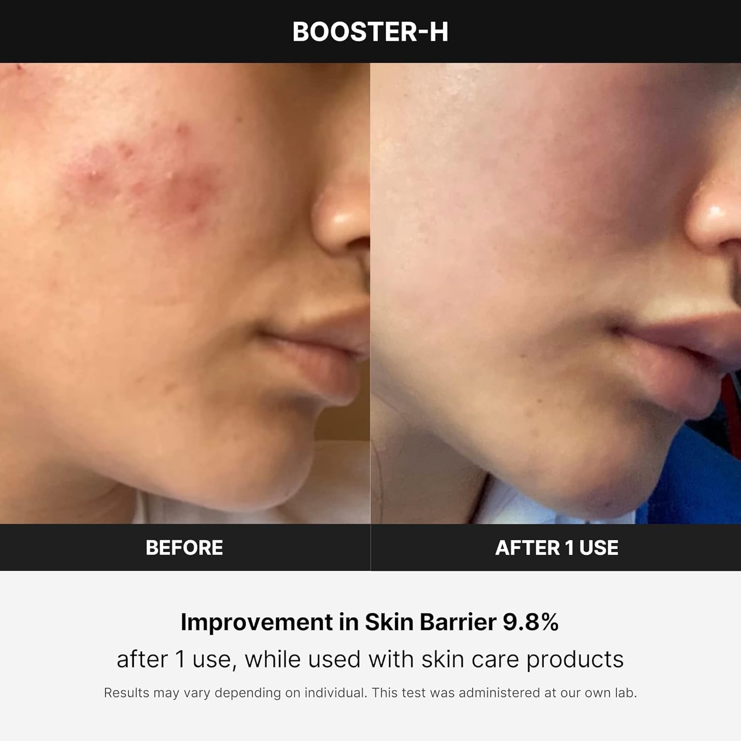 Age-R Booster H - Korean No.1 Skin Care Device - Facial Glow Booster for Maximizing and Boosting Skin Care Absorption - Needle Free